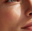 Volume Restoration (Dermal Fillers)