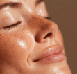 Microneedling Therapy